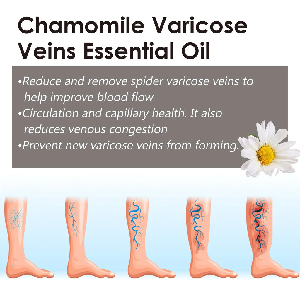 10ml chamomile essential oil bottle for leg care and massage application