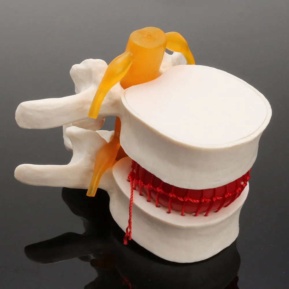 White PVC anatomical model of a human lumbar intervertebral disc for medical demonstration.