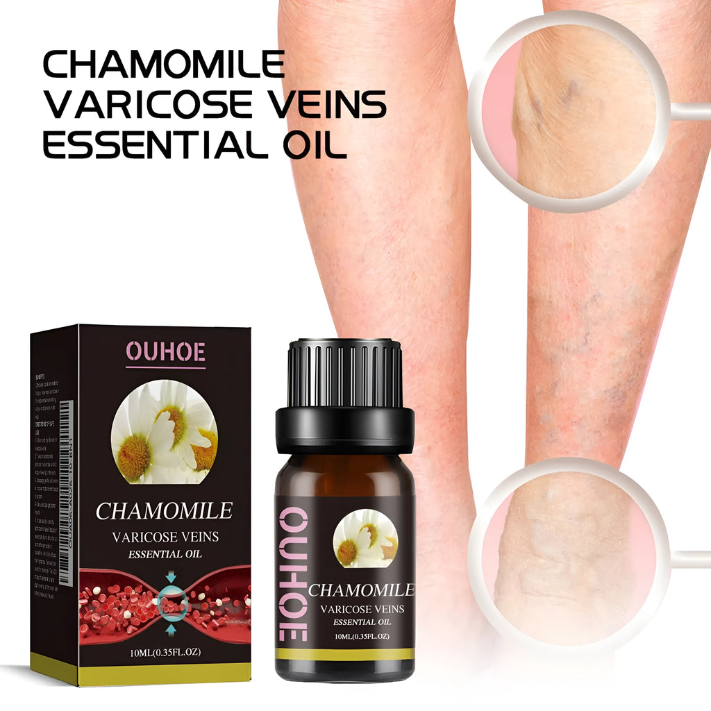 10ml chamomile essential oil bottle for leg care and massage application