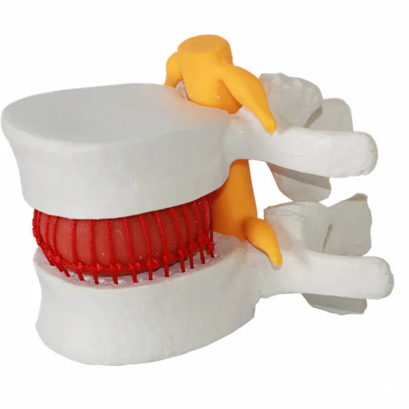 White PVC anatomical model of a human lumbar intervertebral disc for medical demonstration.