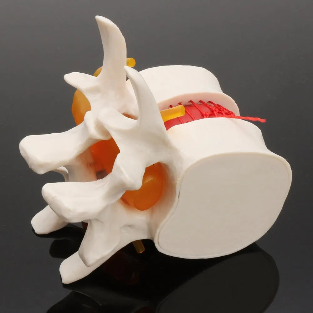 White PVC anatomical model of a human lumbar intervertebral disc for medical demonstration.