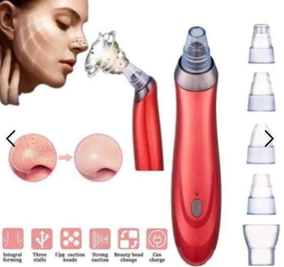 Electric blackhead remover device with multiple nozzle attachments for facial pore cleaning
