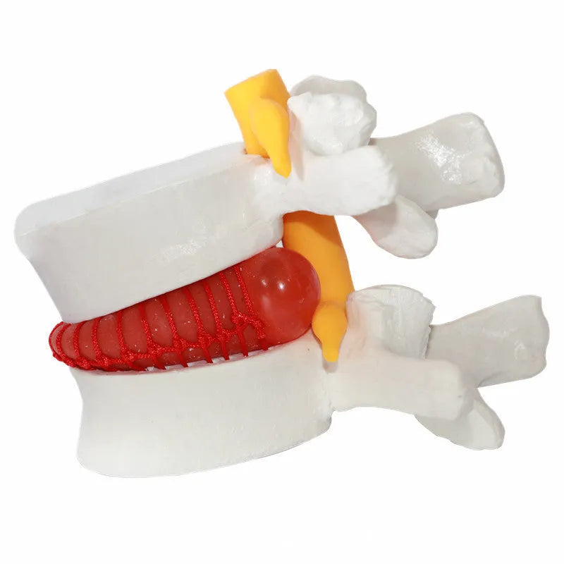 White PVC anatomical model of a human lumbar intervertebral disc for medical demonstration.