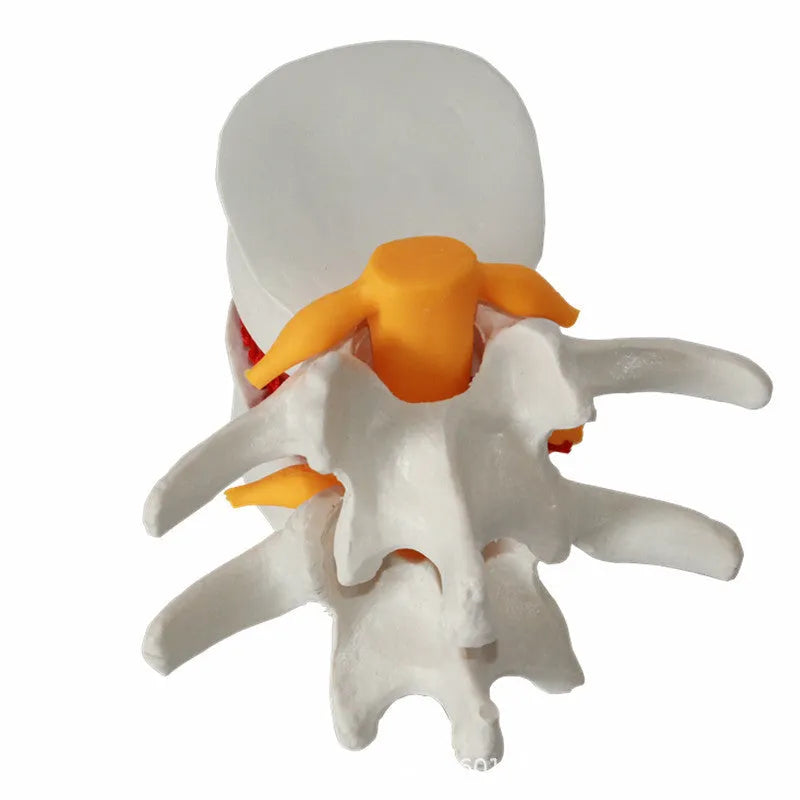 White PVC anatomical model of a human lumbar intervertebral disc for medical demonstration.