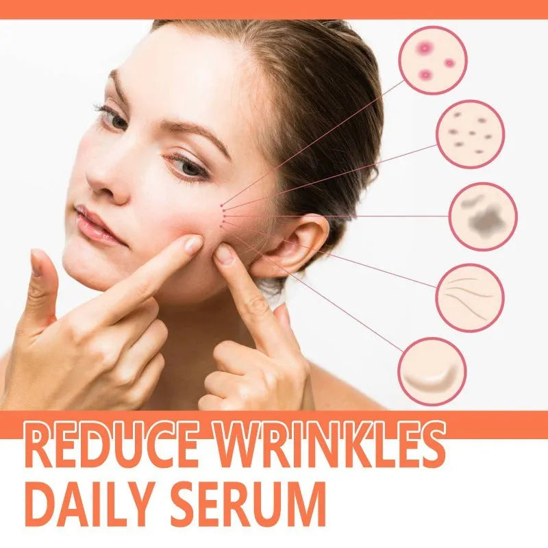 30ml glass bottle of rose essential oil serum with a dropper for facial skincare.