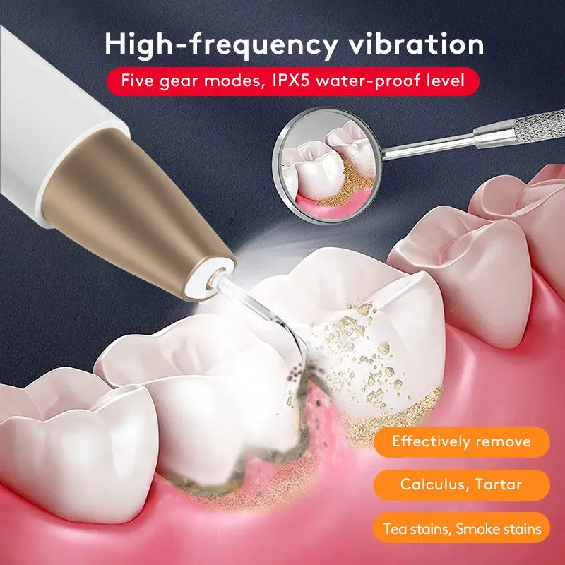 Gold ultrasonic dental cleaning device for removing tartar and teeth stains at home