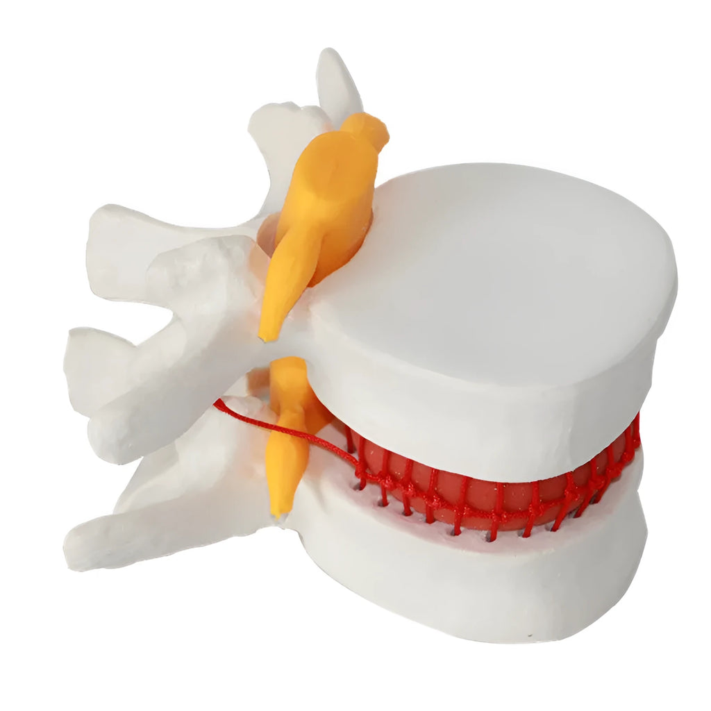 White PVC anatomical model of a human lumbar intervertebral disc for medical demonstration.