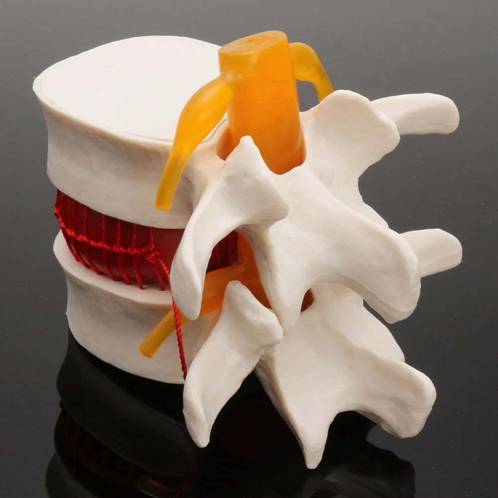 White PVC anatomical model of a human lumbar intervertebral disc for medical demonstration.