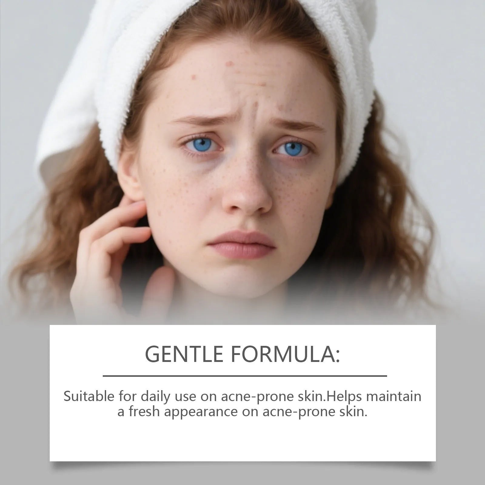 Transparent hydrocolloid facial acne patches for blemish treatment