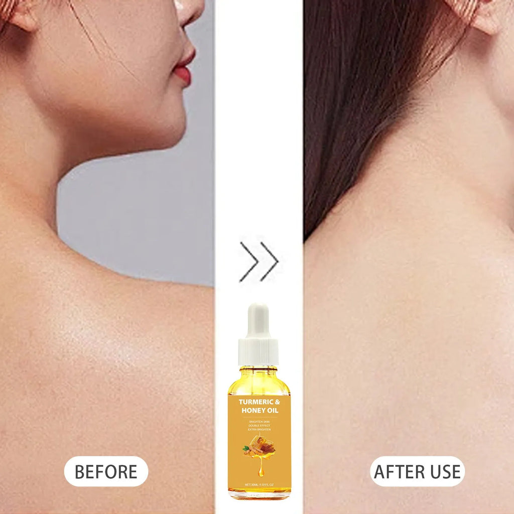 30ml Turmeric Honey Essential Oil bottle in neutral packaging for facial beauty application