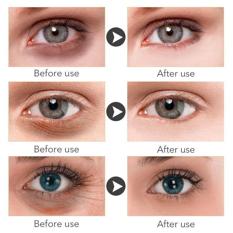 30ml Beauty Eye Cream tube for women's eye area skincare