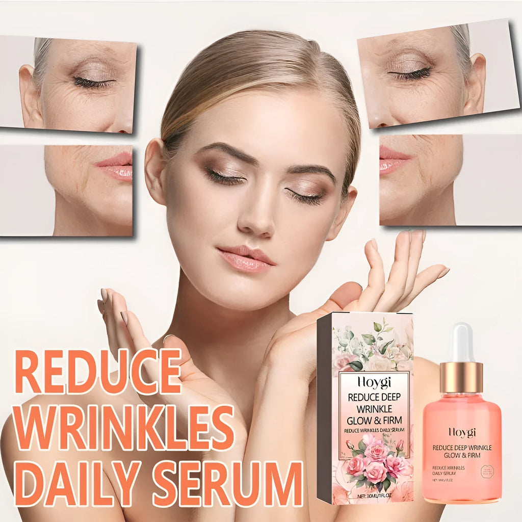 30ml glass bottle of rose essential oil serum with a dropper for facial skincare.