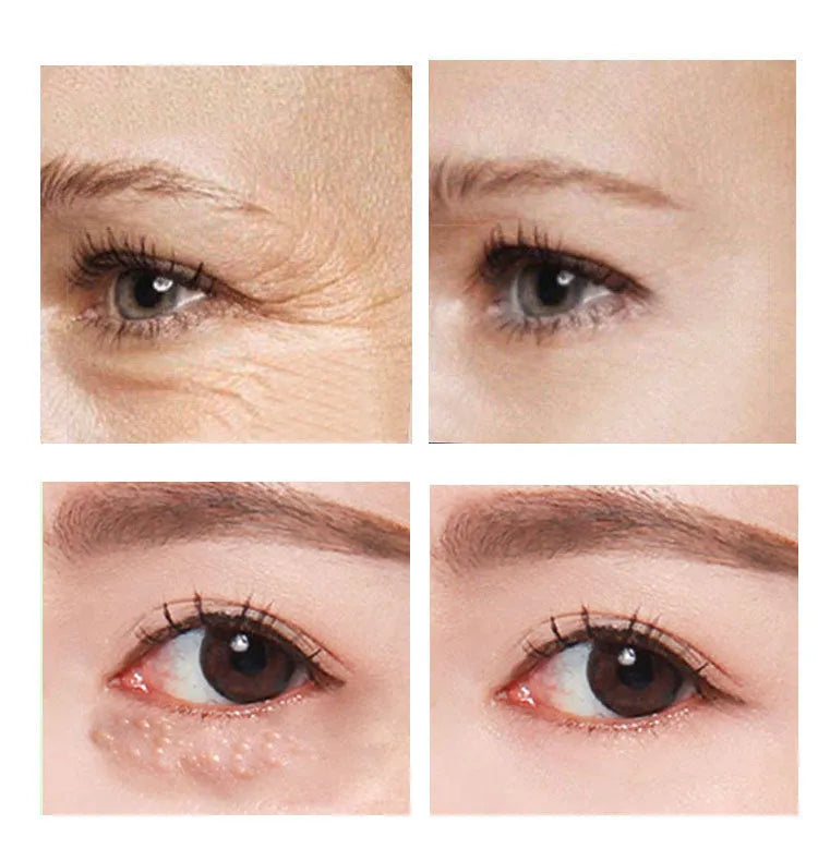 30ml Beauty Eye Cream tube for women's eye area skincare