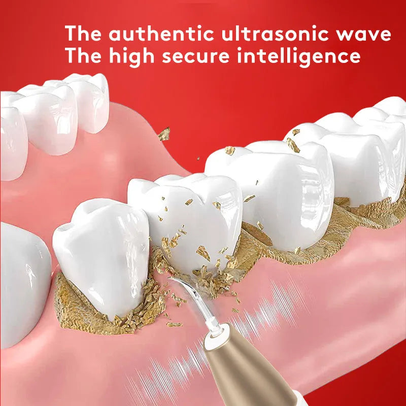 Gold ultrasonic dental cleaning device for removing tartar and teeth stains at home